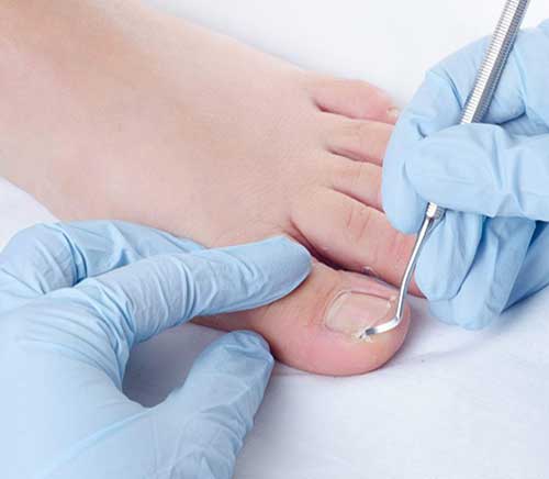 professional chiropodist ashton