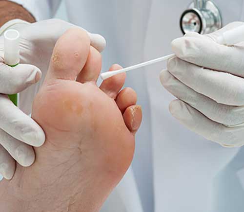professional chiropodist ashton