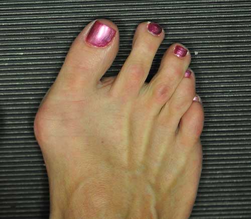 professional podiatrist ashton