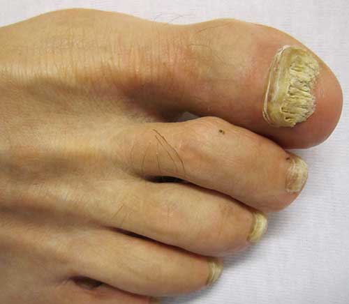 professional chiropodist ashton