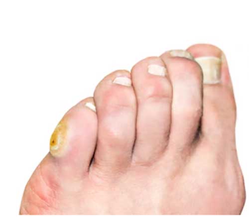 professional chiropodist ashton